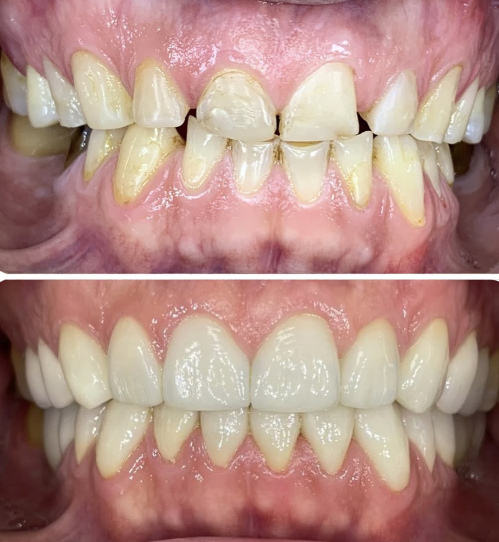 cas-clinique-rehabilitation-2