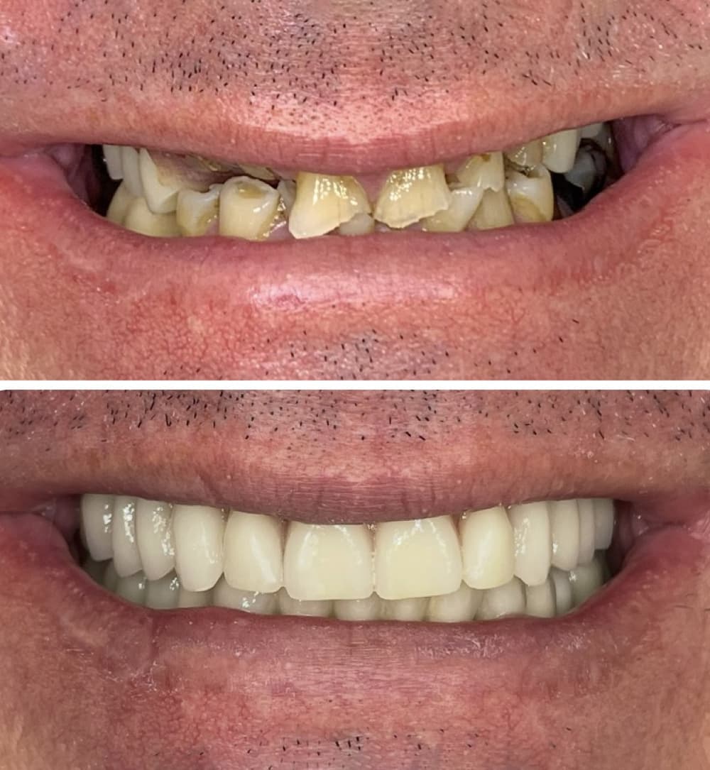 cas-clinique-rehabilitation-4